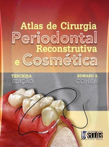 Atlas De Cirurgia Periodontal Reconstrutiva E Cosmetica (Em Portuguese do Brasil)
