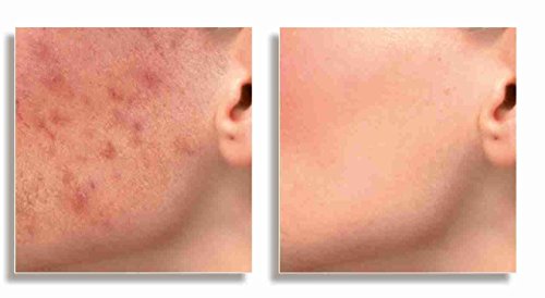 dermacol Make de Upo Cover – El Belleza geheimis la Stars – Color Claro 209