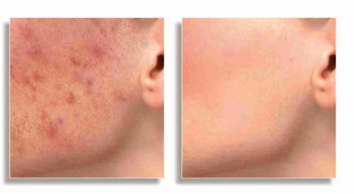 Dermacol Make-Up Cover (Maquillaje cubre tatuajes y cicatrices), 223