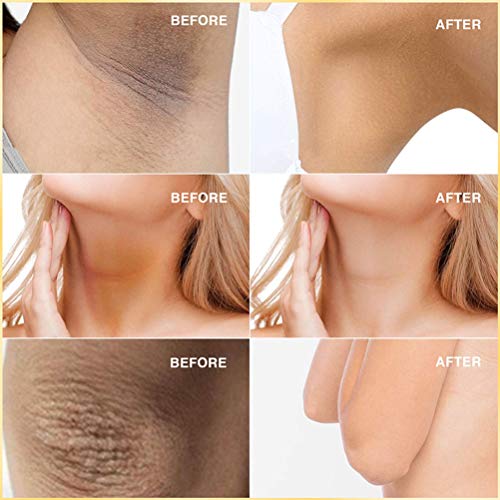 DUOCACL Barra de ácido kójico para aclarar la Piel, Limpiador de Piel blanqueador Hecho a Mano para Rostro y Cuerpo