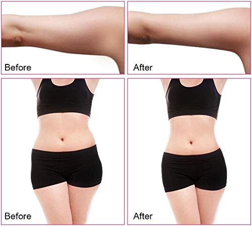 DXDUI R. F multipolar Cuerpo de Adelgazamiento viga de la máquina de elevación Belleza Herramientas,Nosotros