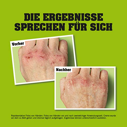 El set de regalo de O'Keeffe, incluye 1 crema de manos Working Hands, 1 crema para pies Healthy Feet, 1 bálsamo labial sin perfume.