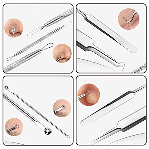 Juego de 6 herramientas para eliminar puntos negros, kit profesional de extracción de granos, incluye pinzas curvas para la cabeza blanca, kit de eliminación de acné, tratamiento de manchas