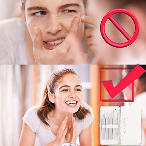 Juego de 6 herramientas para eliminar puntos negros, kit profesional de extracción de granos, incluye pinzas curvas para la cabeza blanca, kit de eliminación de acné, tratamiento de manchas