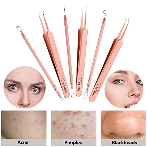 Juego de herramientas para eliminar puntos negros y espinillas, extractor de comedones, granos, acné, puntos blancos,eliminación de manchas, extracción de puntos negros, 6 unidades (oro rosa)