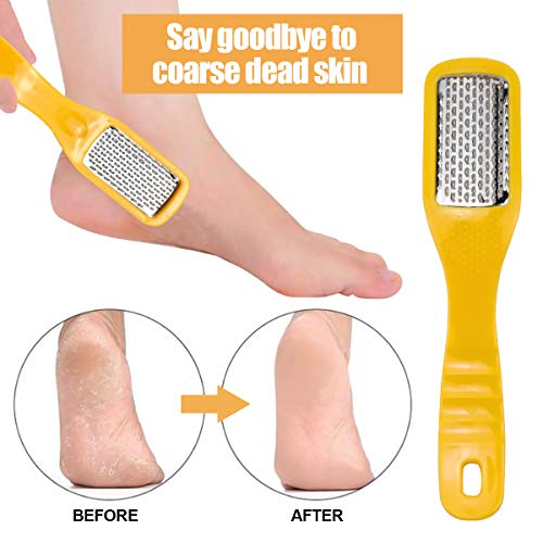 Kit de Pie para Pedicura 10 en 1 Lima Pies Removedor De Piel Dura Eliminar Durezas y Callos,Quita Durezas para Pies,Lima de Callos de Acero Inoxidable,Corta Callos Pies,Quitadurezas de Callos