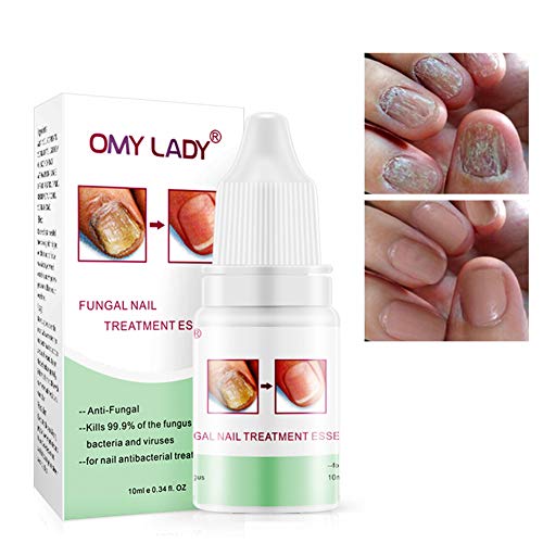 Líquido reparador de uñas El hongo Yiitay líquido deja de ser efectivo contra el hongo de uñas Reparación de onicomicosis y fortalecimiento de uñas de los pies y uñas