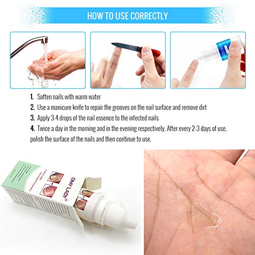 Líquido reparador de uñas El hongo Yiitay líquido deja de ser efectivo contra el hongo de uñas Reparación de onicomicosis y fortalecimiento de uñas de los pies y uñas