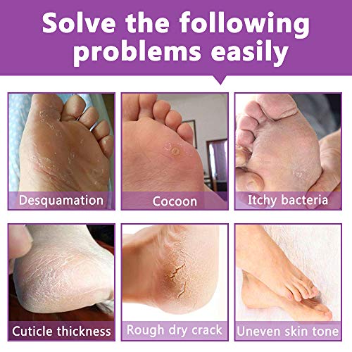 Mascarilla Exfoliante Para Pies, 5 Pares De Calcetines Hidratantes Exfoliantes Para Eliminar Callos Y Reparar Cicatrices áSperas, Pie Suave (Lavanda)