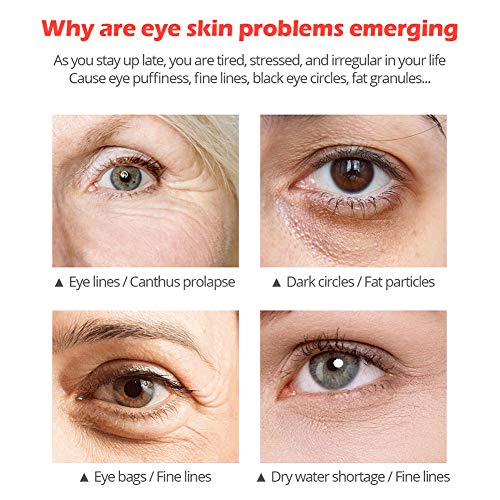 Matedepreso Anti-Wrinkle Peptide Collagen Dark Circles Gel Eye Cream For Vibrant Glamour(20G)