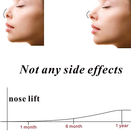 SHOUJIK Corrector de Nariz Ancha Respingadores Silicona para el Puente de la Nariz de Las Herramientas Correctoras Natural hasta Una Forma de Elevación Más Delgada,2 Pcs