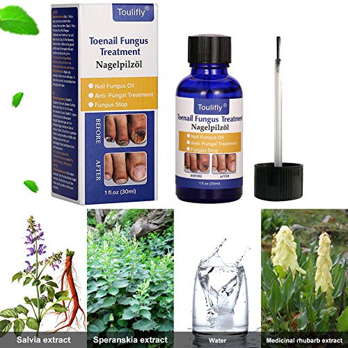 Solución de uñas micóticas, Tratamiento de Uñas de los hongos, Apto para dedos y pedicura, Solución de uñas de Hongos para uñas descoloridas, Gruesas, desmenuzadas y con Hongos