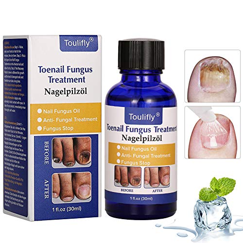 Solución de uñas micóticas, Tratamiento de Uñas de los hongos, Apto para dedos y pedicura, Solución de uñas de Hongos para uñas descoloridas, Gruesas, desmenuzadas y con Hongos