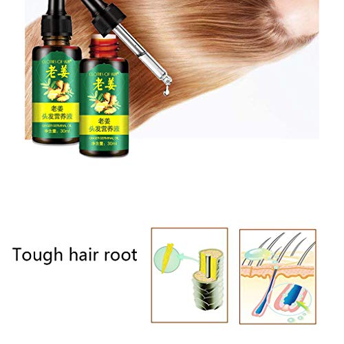Sunlera 30ml Jengibre Germinal Esencia de Pelo la raíz Aceite de raíz de Nutrición Anti-caída ungüento de petróleo el Crecimiento del Pelo