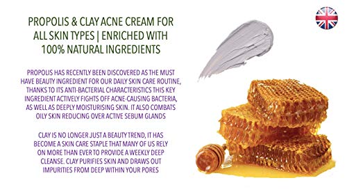 Viva Natura, Crema Para el Acné con Propóleos y Arcilla, Todo Tipo de Piel, Enriquecido con Ingredientes 100% Naturales, 20ml