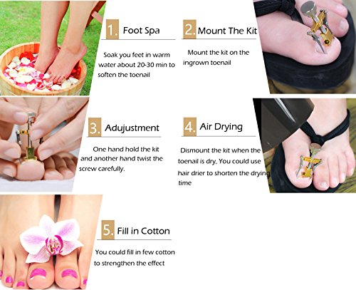 WeeDee - Uñas Encarnadas Corrector, Pedicura Tratamiento Para Defecto De Crecimiento De Las Uñas Paronychia Ingrown Toenail