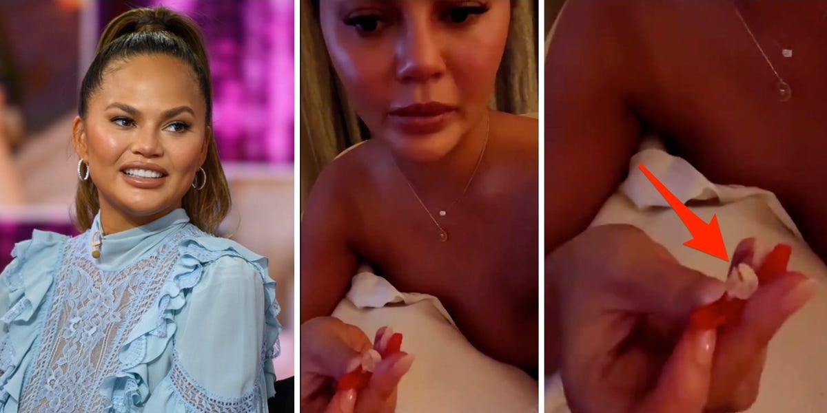 Chrissy Teigen dice que perdió un diente mientras comía un rollito de fruta