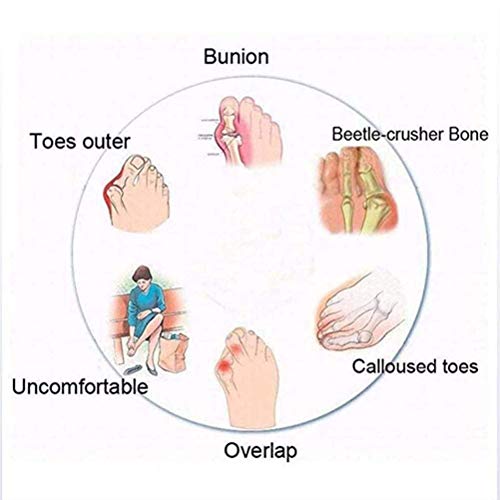 JXJ Sandalias Informales de Plataforma para Mujer, Corrector ortopédico de juanetes, Sandalias ortopédicas para pies con Soporte de Arco, cómoda Plataforma Plana, 44