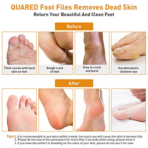 Lima Eléctrica Pedicura, QUARED Eléctrico Lima Pies Profesional Recargable, Elimina Fácilmente Callos y Piel con 2 Velocidades y 3 Repuestos