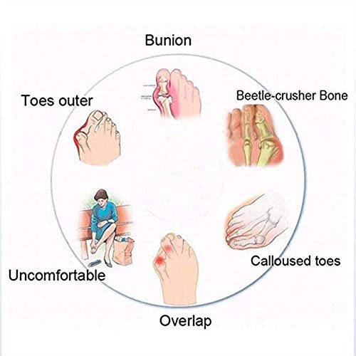 QLIGHA Chanclas de Cuero con corrección de pies para Mujer, Corrector ortopédico para juanetes, Sandalias de Verano con Punta Abierta, para Viaje en la Playa, Chanclas Ligeras, Zapatos de Playa, ne