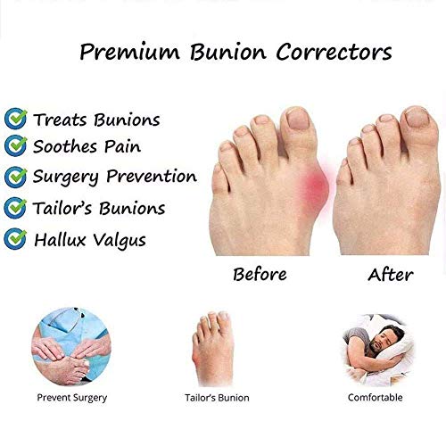 QLIGHA Moda Suela Plana, Dedo Gordo del pie, corrección del pie, Sandalias, Playa, Zapatos de Viaje, Dedo del pie, Chanclas, Zapatillas, Corrector, pie, ortopédico, juanete, Corrector, Plata, 37