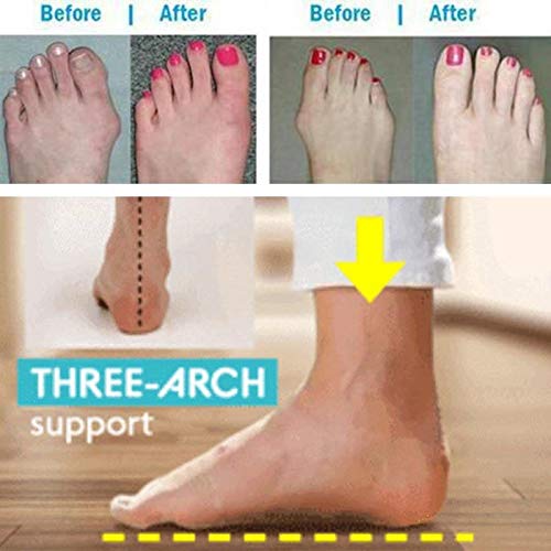 Sandalias Planas Cómodas para Mujer Zapatos Ortopédicos de Verano Sandalias de Corrección de Pie con Dedo Gordo Corrector de Juanetes Ortopédico Zapatillas de Viaje de Playa,Marrón,42