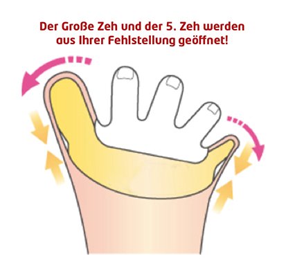 BunionETTE Cinderella - Vendaje de corrección (juanete y quinto dedo en varo) derecho tamaño S