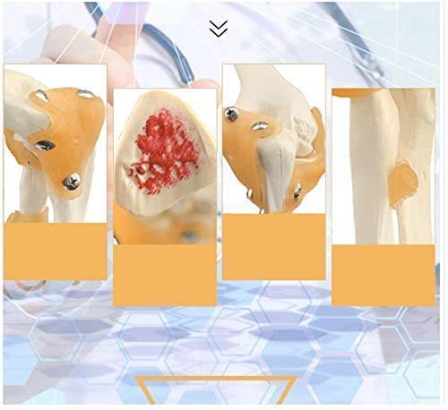 CHHD Modelo de articulación de búsqueda de Esqueleto Humano del Codo Médico, Modelo de Movimiento de la articulación del Codo con el Modelo de legama esquelético