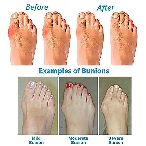 QDY Sandalias Planas para Mujer Bohemia Vintage Jeweled Beaded Toe Ring Sandalias de Gladiador Zapatos de Playa Romanos Clip Toe Flip Flop Thong Zapatos para corrección de Hallux Valgus, Ver