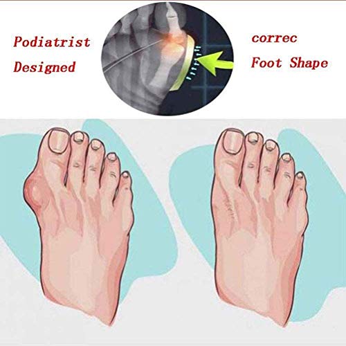 QLIGHA Corrector de juanetes ortopédico para Mujer Sandalias de corrección de pie con Dedo Gordo Suave Informal para Mujer Zapatos de Cuero de PU Zapatilla de Suela Plana con Plataforma cómoda, Neg