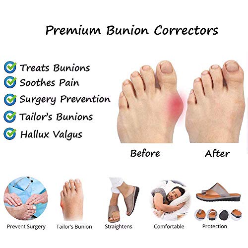 TOT Valgus Bunion Foot Corrector Sandals Mujeres Calzado ortopédico para Huesos del Dedo Gordo del pie con Soporte para el Arco para el Alivio del Dolor Síntomas del juanete,Blanco,37