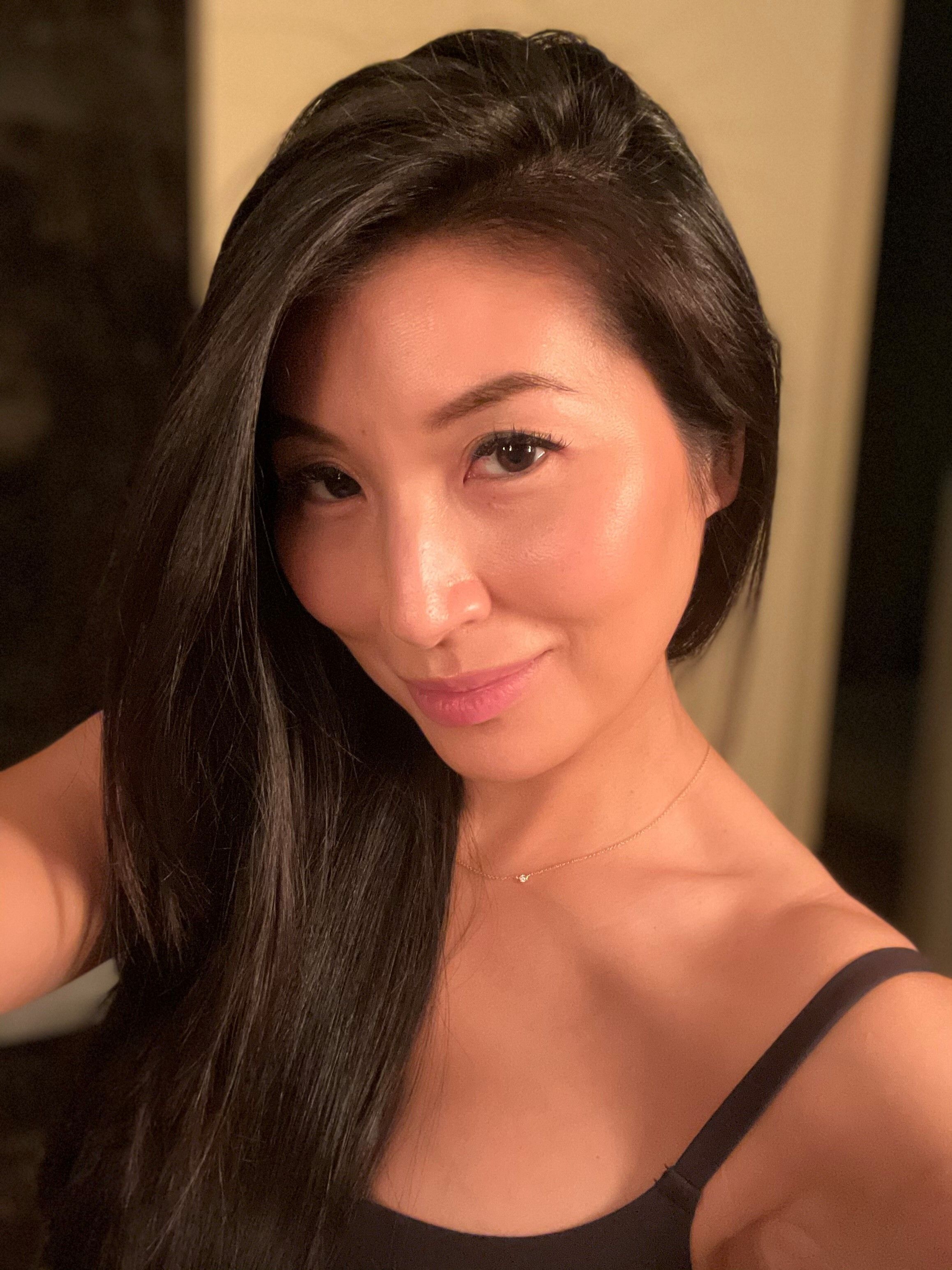 Diarios de Dermatología: "Soy una dermatóloga con manchas oscuras por la exposición al sol; así es como las trato