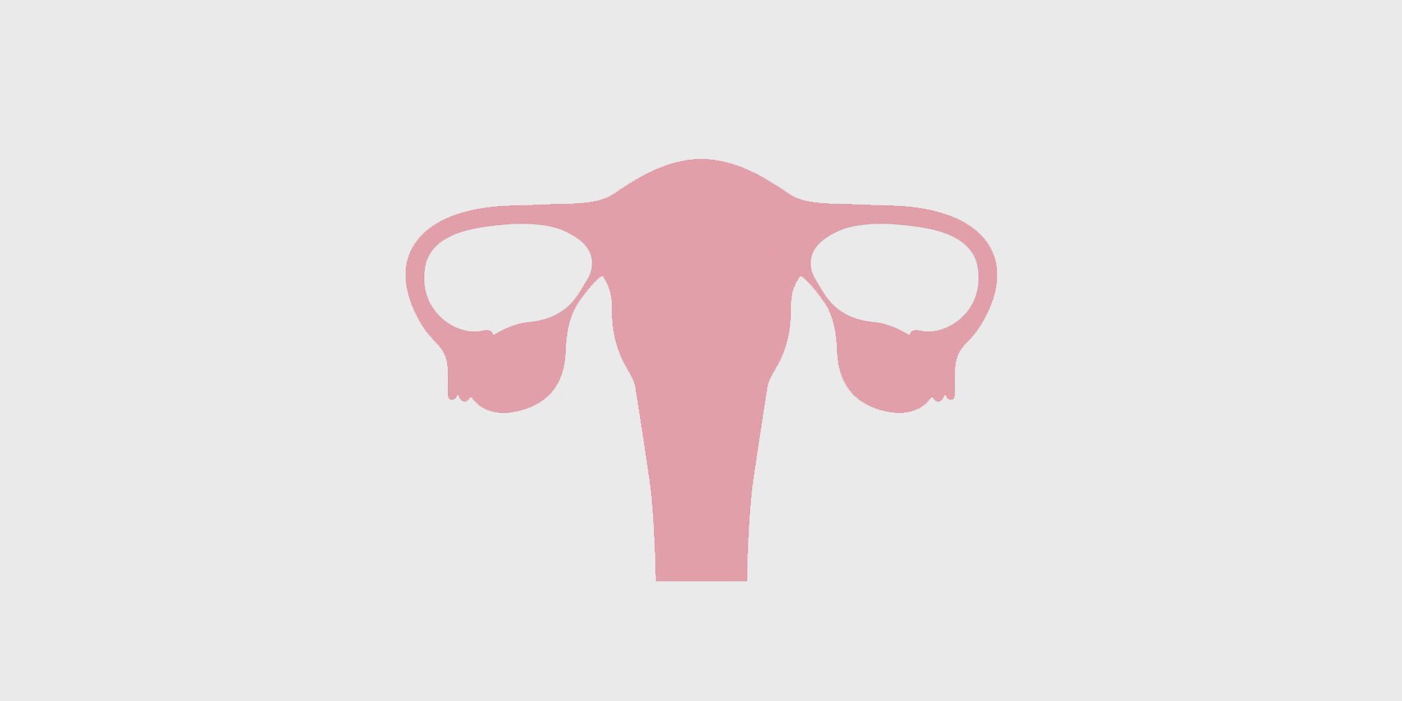 Lo que debe saber sobre su estado de BRCA y el riesgo de cáncer de ovario