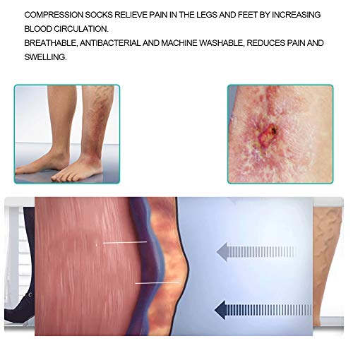 Medias de compresión elásticas opacas, pantimedias de compresión para mujeres y hombres, medias altas hasta el muslo, punta abierta, longitud de la rodilla, venas varicosas(XL)