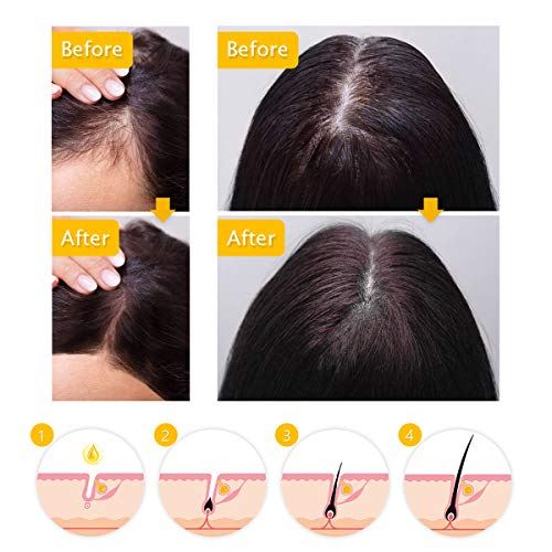 Y.F.M Crecimiento de Cabello, Tratamiento para el Cabello, Aceite para el Crecimiento de Pelo, Hair Serum, Estimula el Crecimiento de Pelo para Hombres y Mujeres