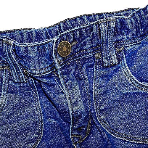 Botones de Jeans,100 Piezas Botones Jeans Metalicos,Botones Vaqueros Presion,Juego de Botones para Pantalones,con Caja de Almacenaje,para Jeans,Chaquetas,Trajes,Camisas,Vestidos,DIY,17mm