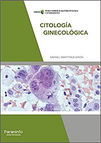 Citología ginecológica