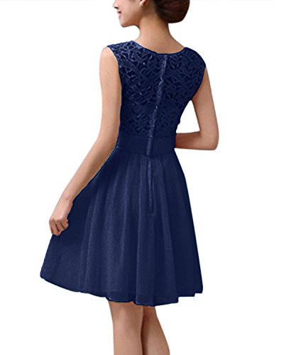 ZANZEA Mujer Vestido Encaje Gasa Verano Sin Manga Elegante Vestidos de Cóctel Fiesta Cuello Redondo 03-Armada S