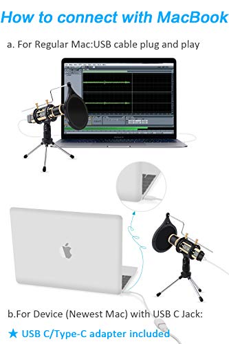 Micrófono de Condensador, ZealSound Radiodifusión Grabación Micrófono de karaoke Estudio en el hogar con soporte para PC Teléfono Podcasters/Smule Transmisión en vivo Podcasting YouTube (Oro Rosa)