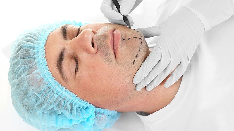 Cómo eliminar la papada