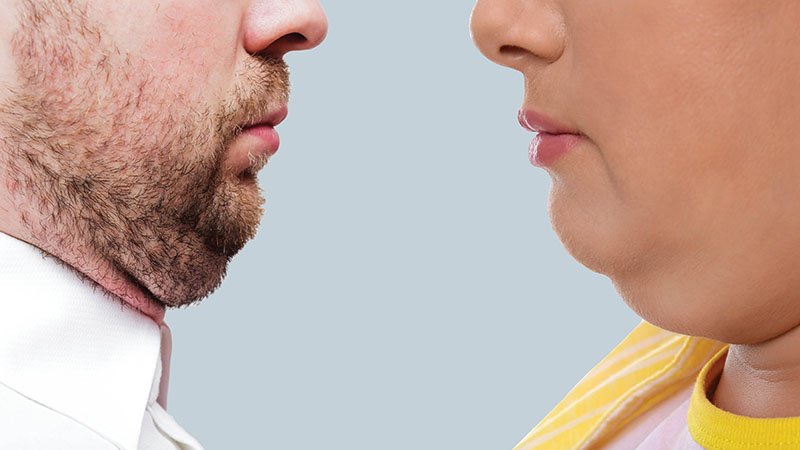 Cómo eliminar la papada