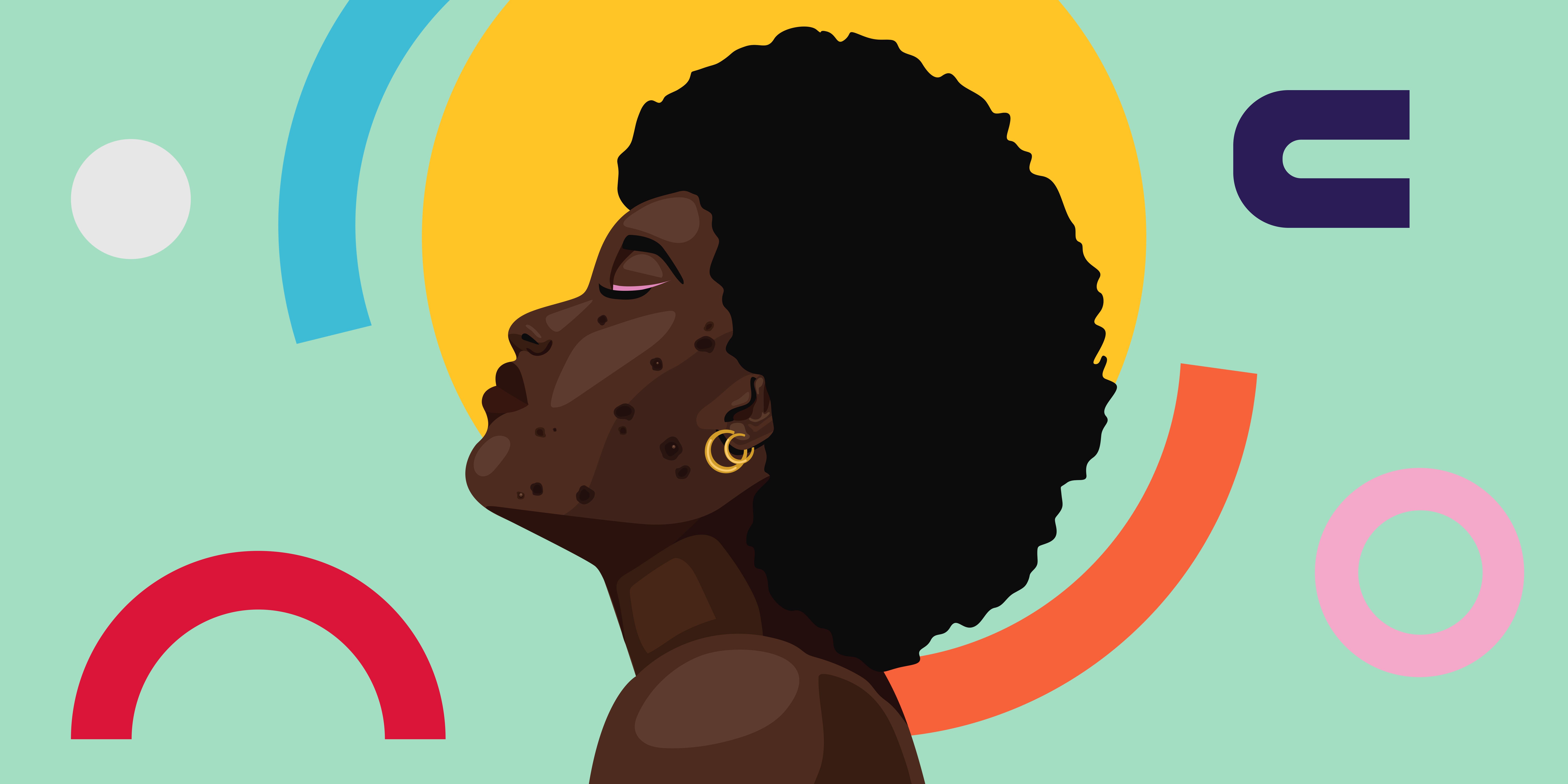 Así afecta la hiperpigmentación a la piel negra, según los dermatólogos