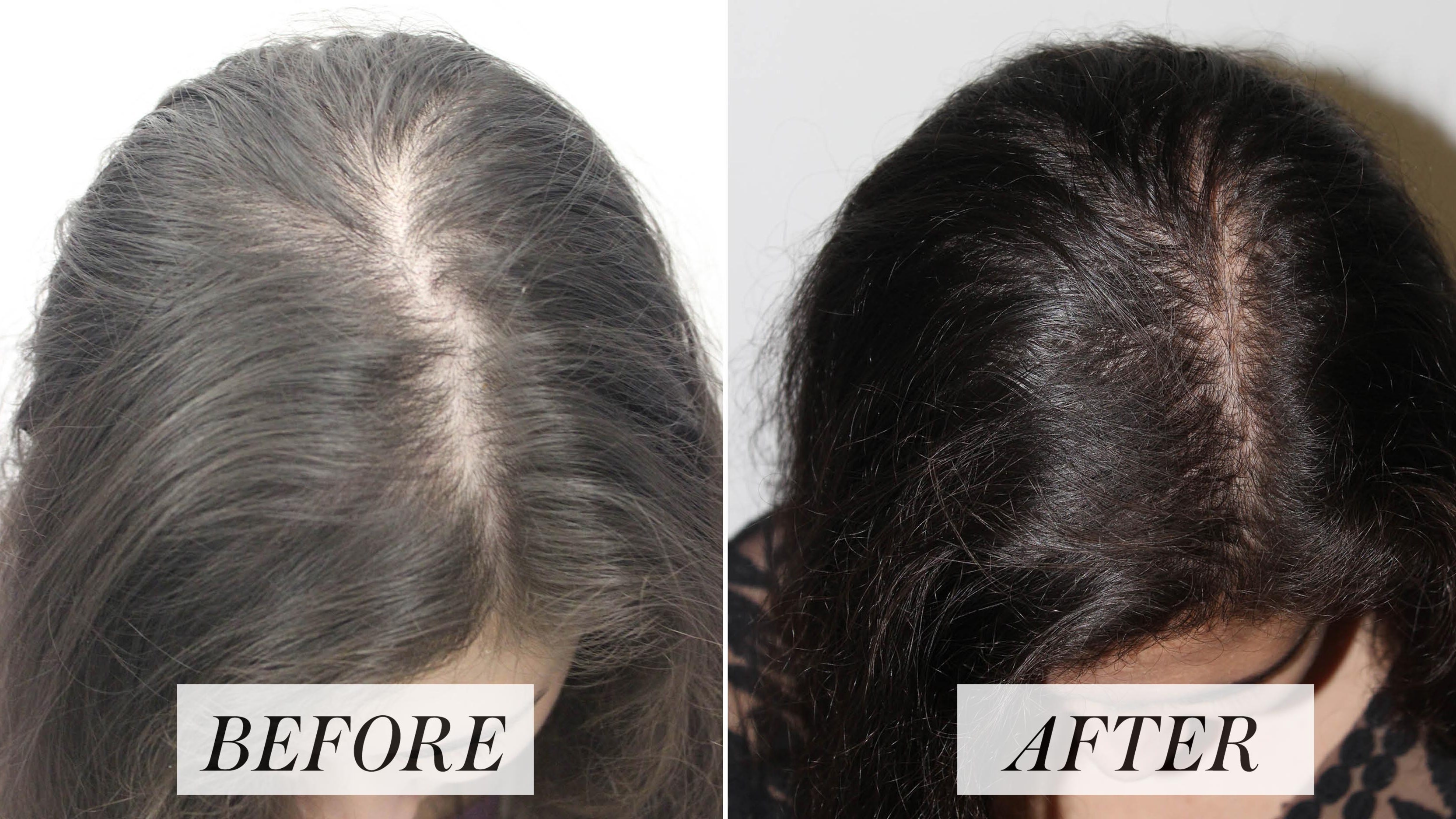 El tratamiento contra la caída del cabello del que probablemente nunca haya oído hablar