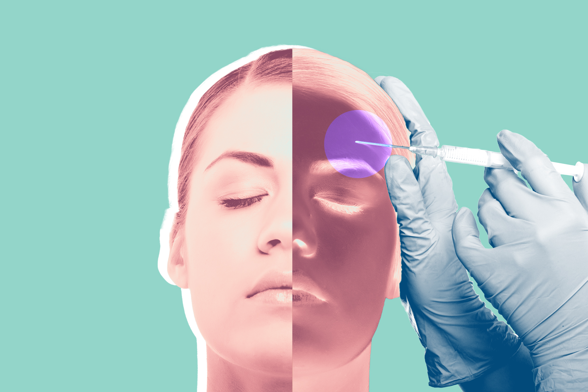 Botox Real Woman Says It Went Wrong