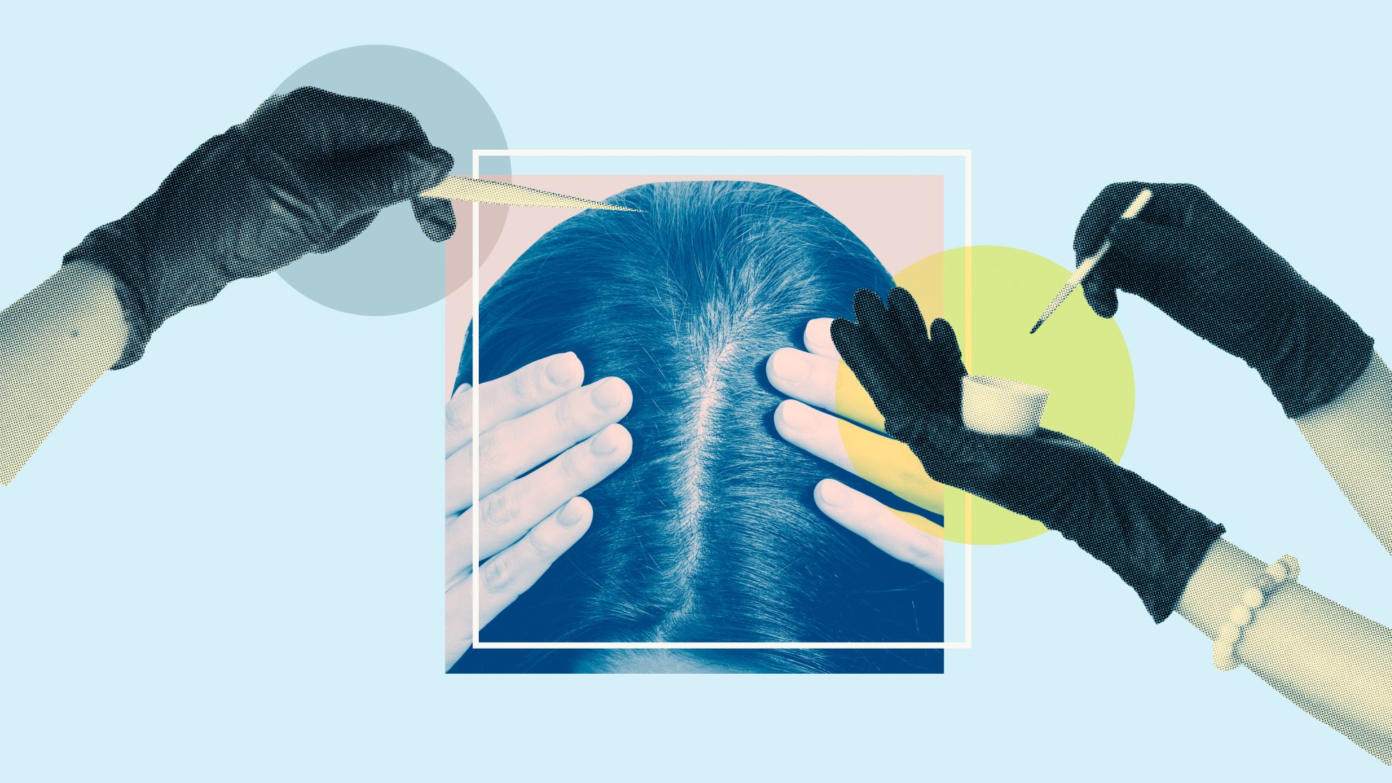 This-Woman-Microbladed-Her-Hairline-on-TikTok-GettyImages-483783625