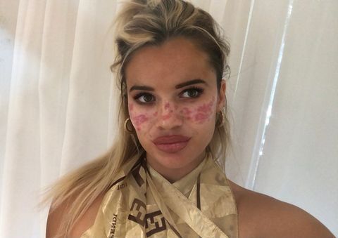 La estrella de 'Gran Hermano Australia', Tilly Whitfeld, comparte fotos gráficas y advierte del hackeo de pecas de TikTok