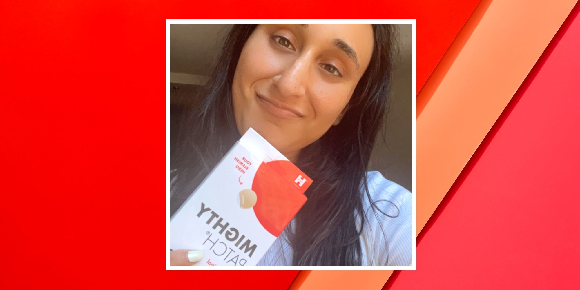 Revisión: Los famosos parches Mighty de TikTok eliminan el acné con suavidad en sólo unas horas