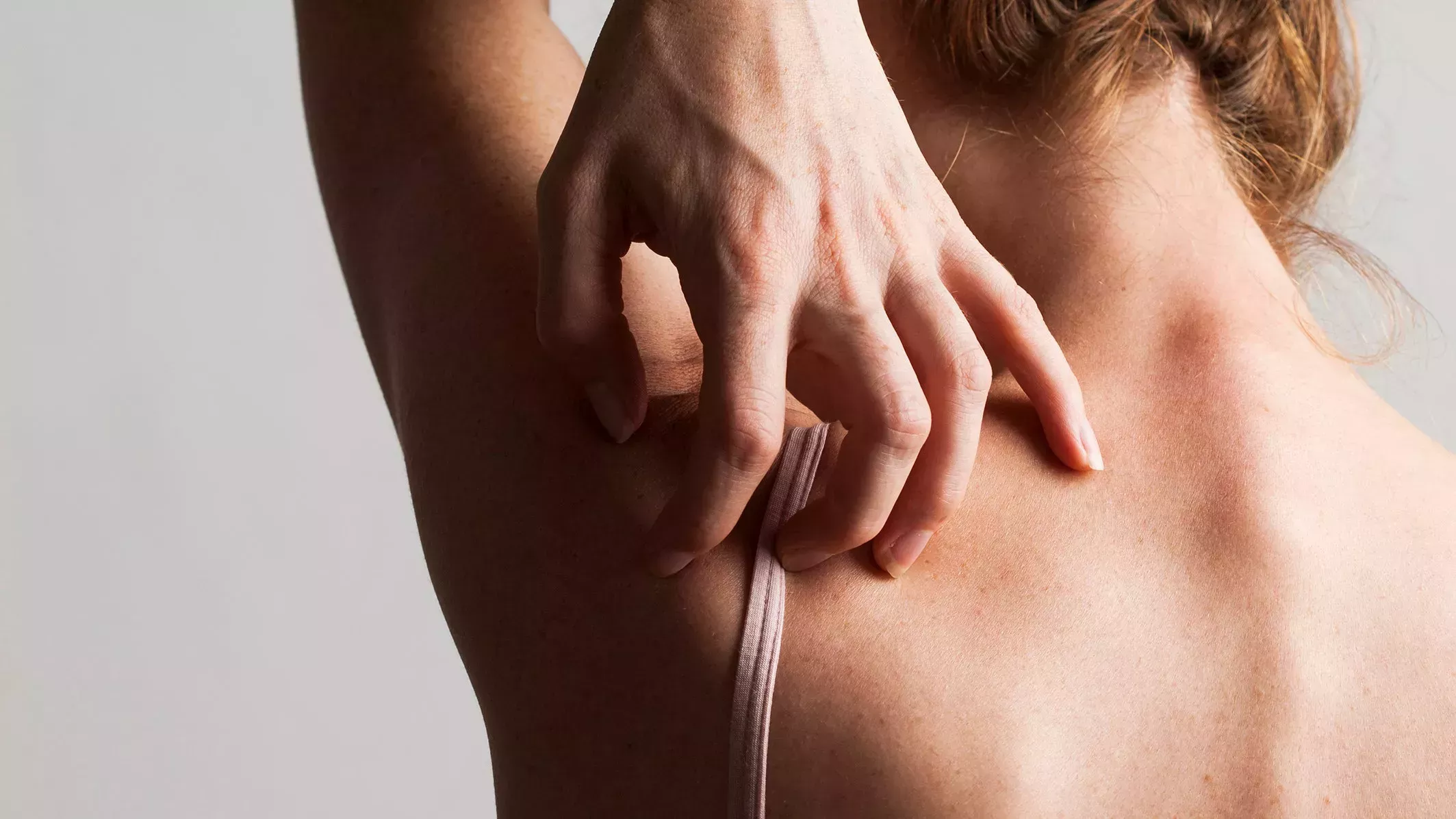 6 afecciones de la piel que no debe intentar diagnosticar usted mismo