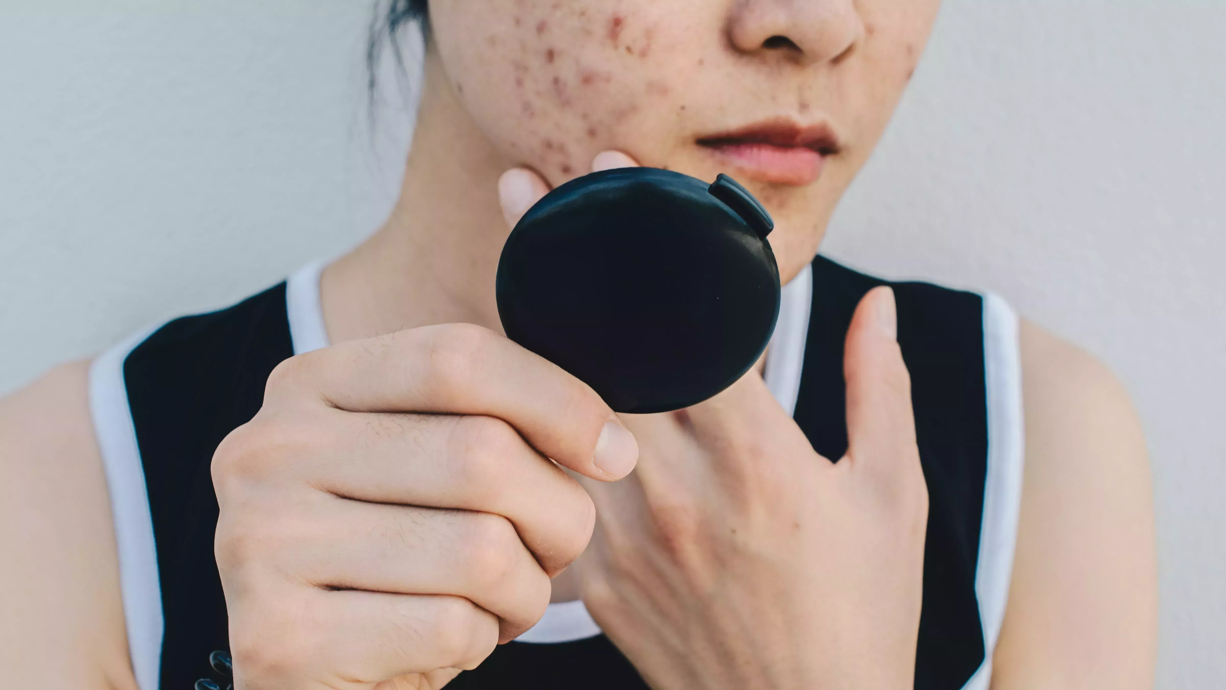 Una mujer en TikTok eliminó su acné rociando agua salada en su cara