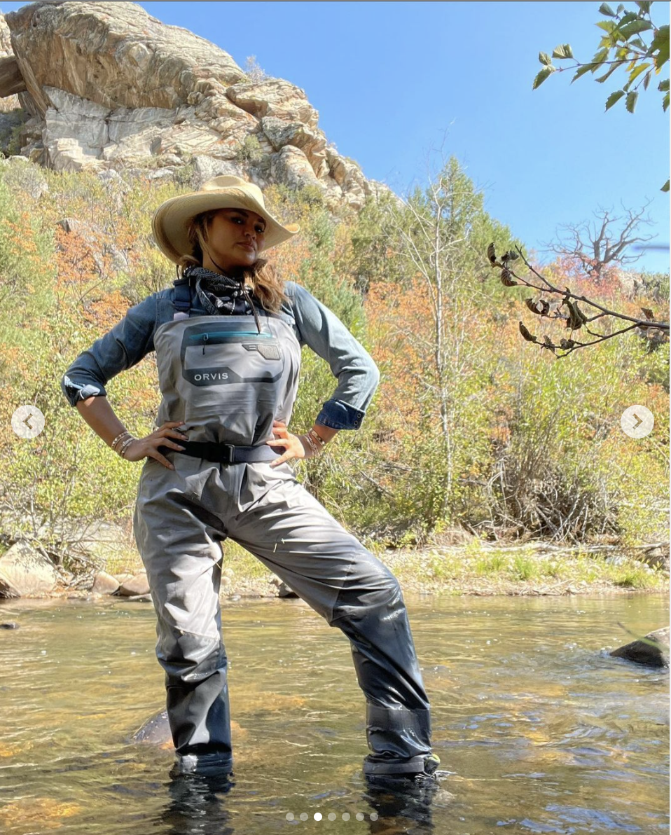 Chrissy Teigen dice que se ha sometido a un procedimiento de eliminación de grasa bucal: ¿Qué es y cuánto cuesta?